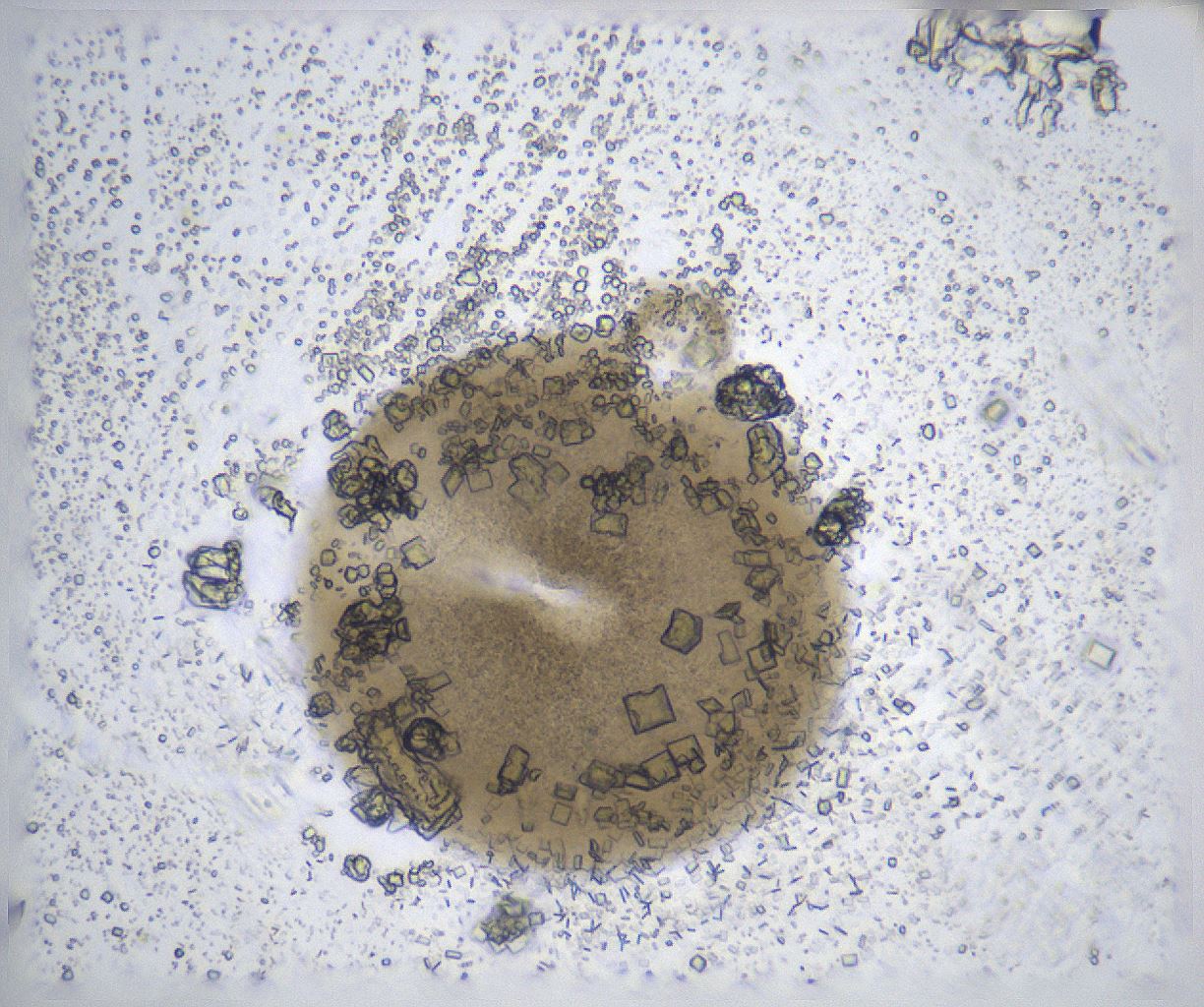 folderID370_plateID2370_batchID11110_wellNum73_profileID1_d1_r169843_ef.jpg