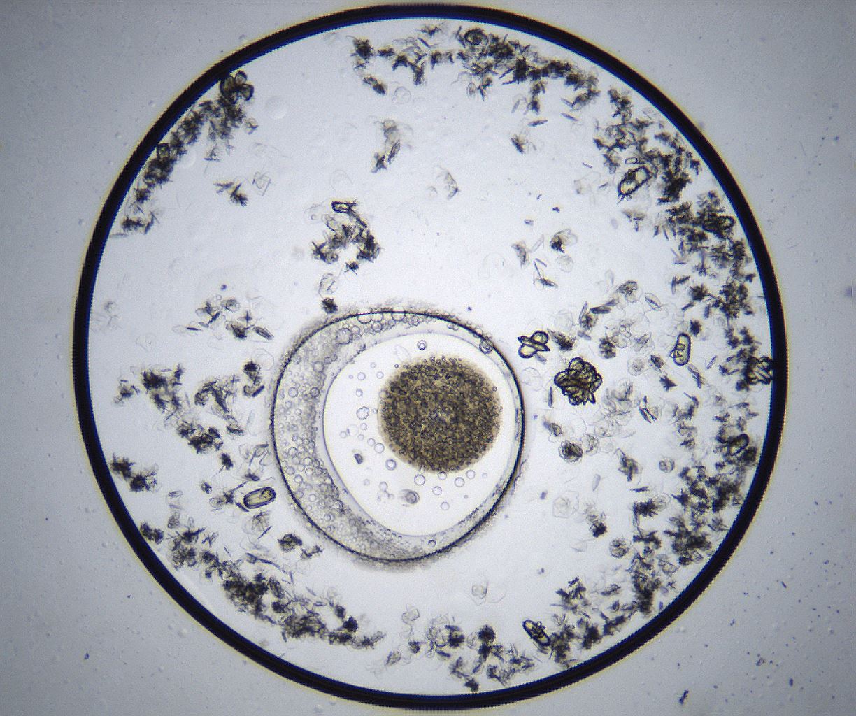 folderID369_plateID2369_batchID11114_wellNum17_profileID1_d1_r170499_ef.jpg