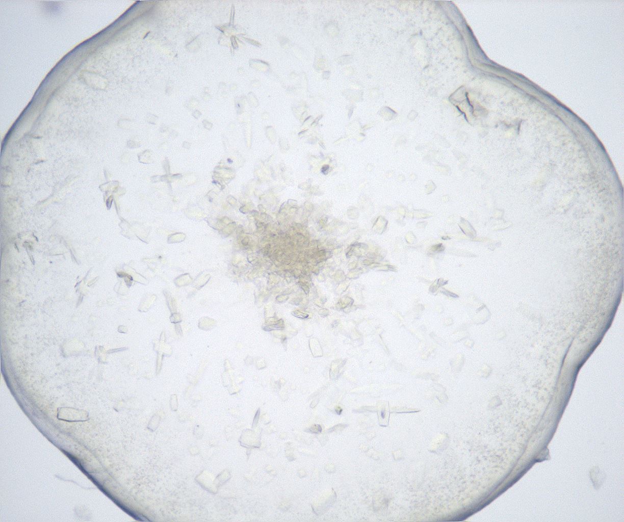 folderID517_plateID2517_batchID12476_wellNum92_profileID1_d1_r189202_ef.jpg