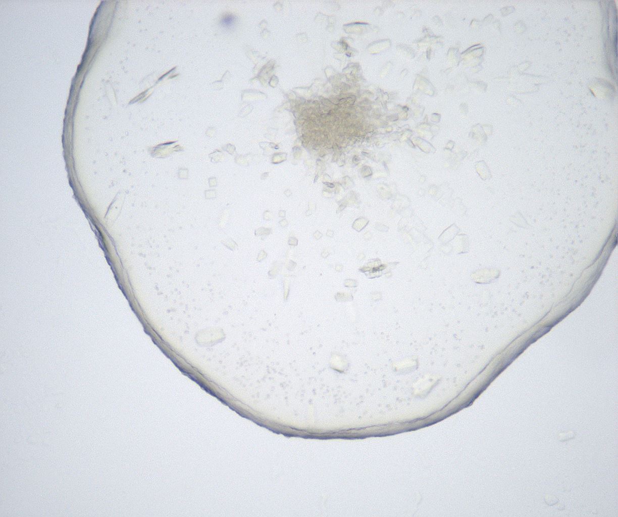 folderID517_plateID2517_batchID12476_wellNum31_profileID1_d1_r189080_ef.jpg