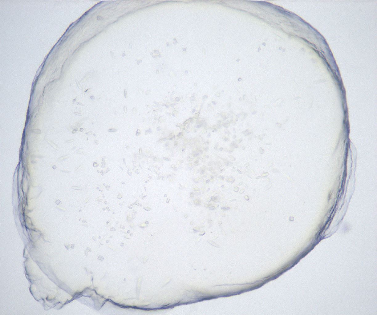 folderID528_plateID2528_batchID12500_wellNum39_profileID1_d1_r191792_ef.jpg