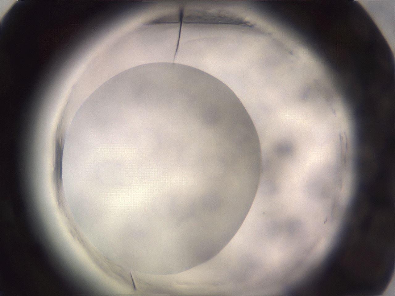 folderID640_plateID2640_batchID13391_wellNum54_profileID1_d1_r214638_ef.jpg