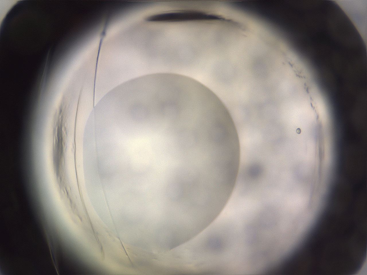 folderID640_plateID2640_batchID13391_wellNum54_profileID1_d2_r214639_ef.jpg