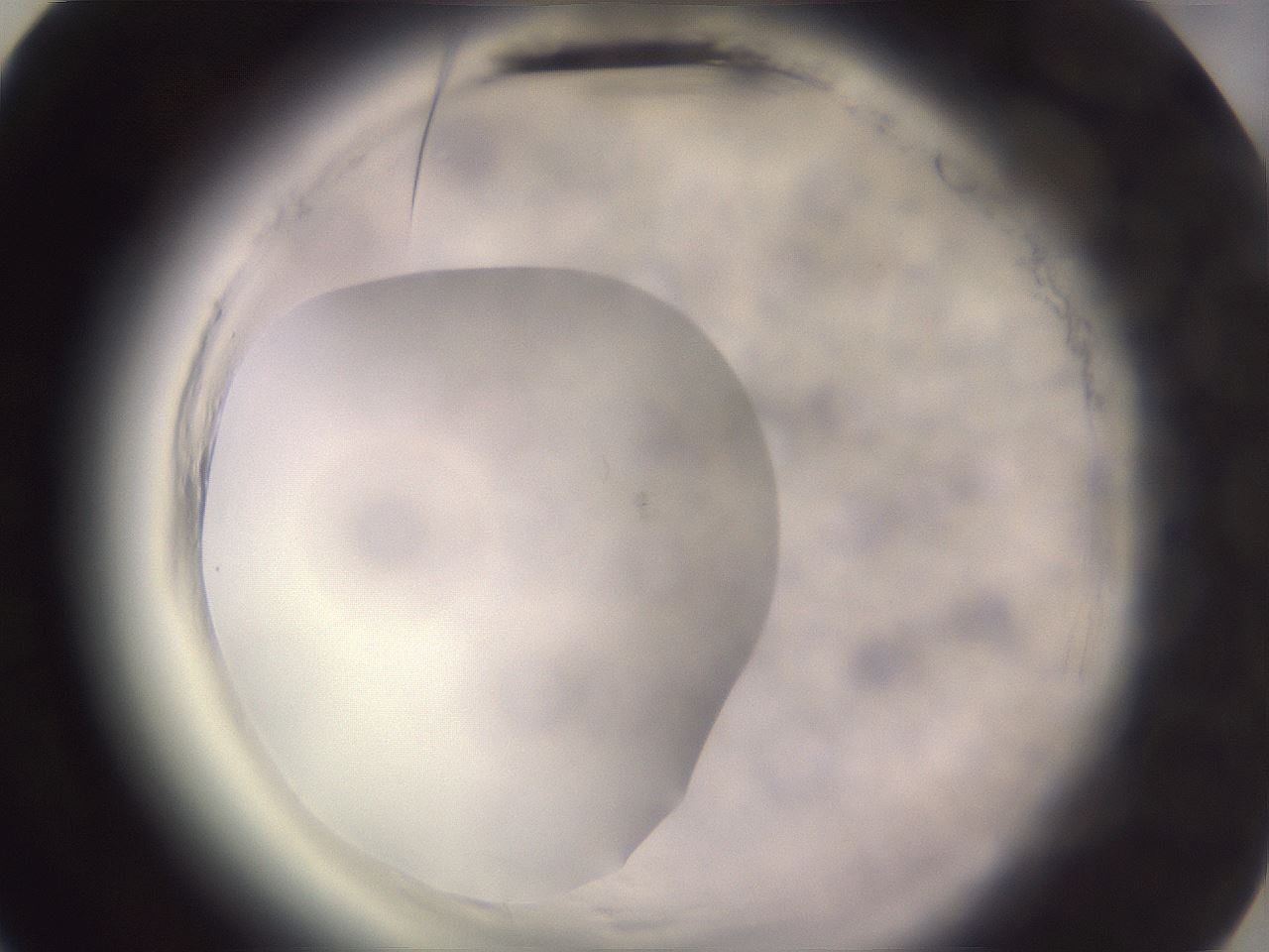 folderID640_plateID2640_batchID13391_wellNum54_profileID1_d3_r214640_ef.jpg