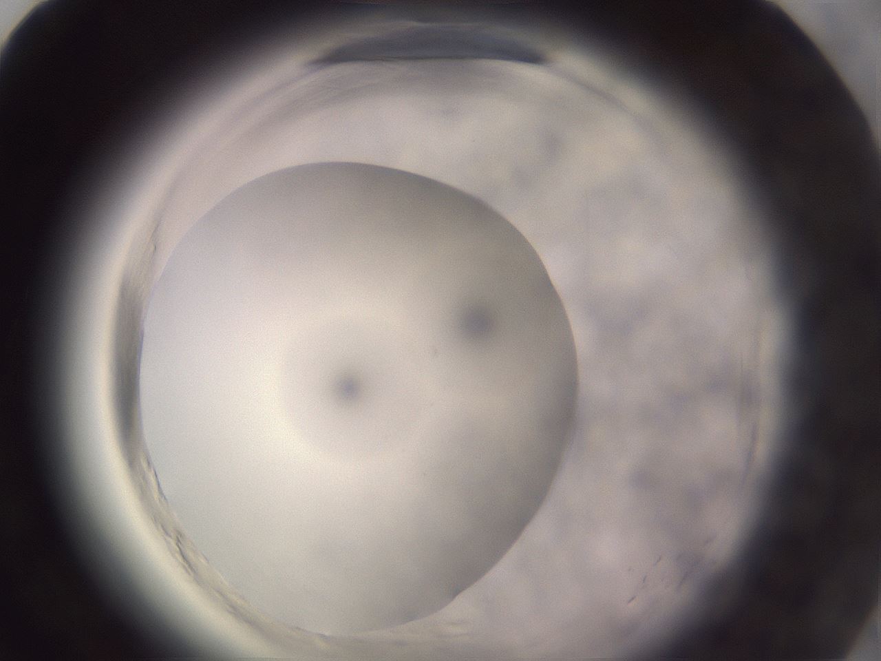 folderID640_plateID2640_batchID13391_wellNum79_profileID1_d1_r214713_ef.jpg