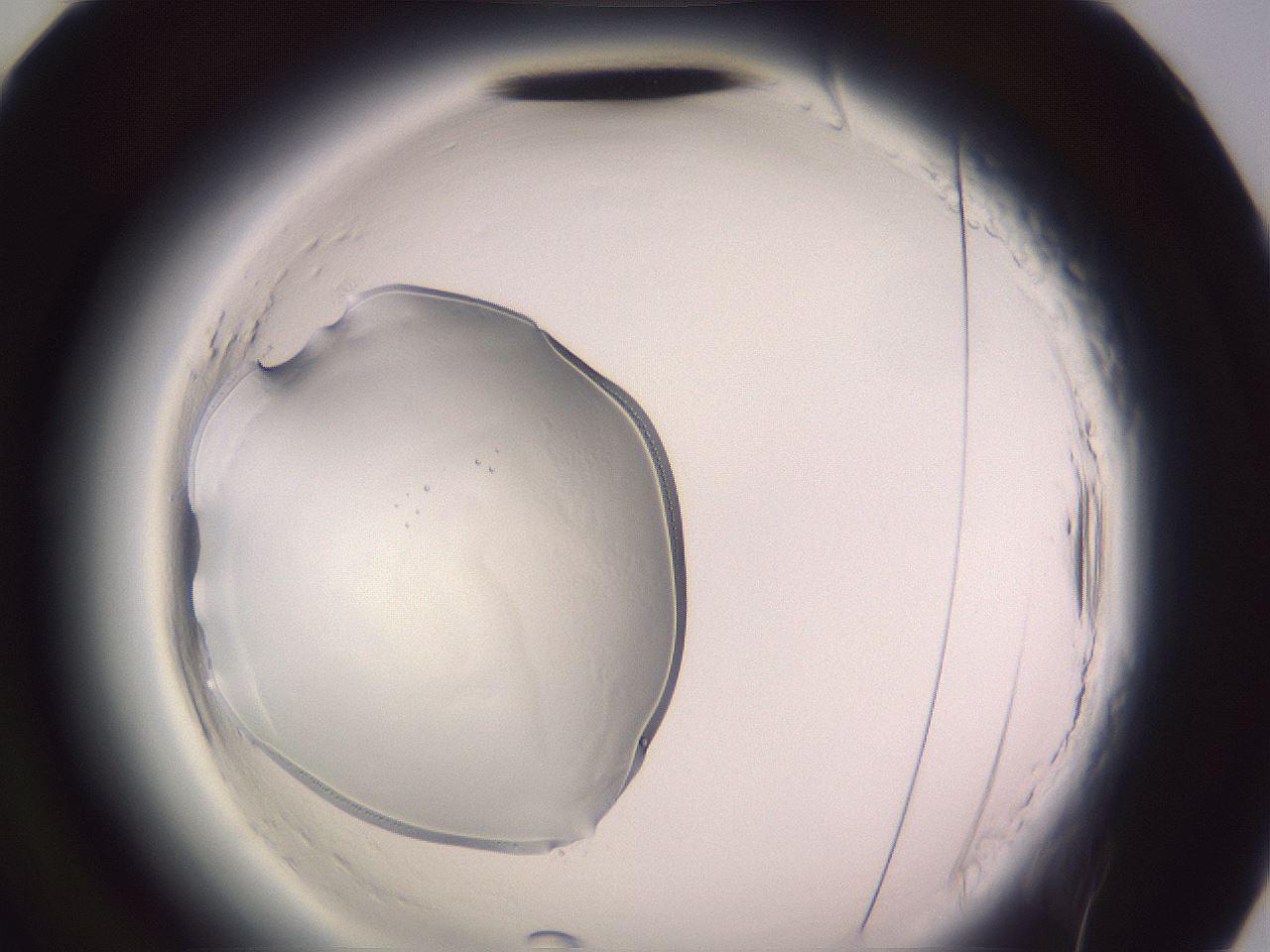 folderID640_plateID2640_batchID13391_wellNum94_profileID1_d2_r214759_ef.jpg