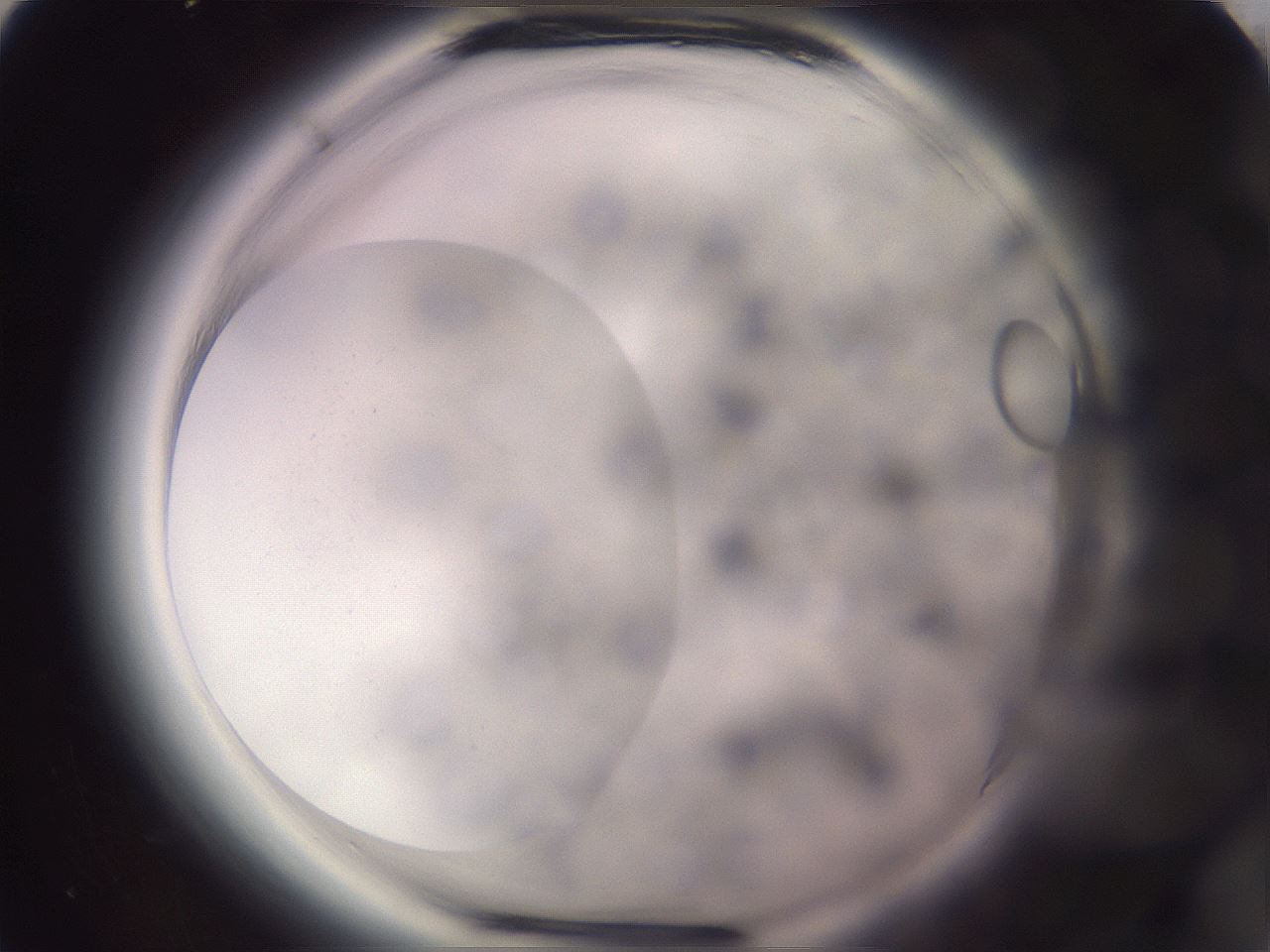 folderID647_plateID2647_batchID13388_wellNum10_profileID1_d1_r213642_ef.jpg