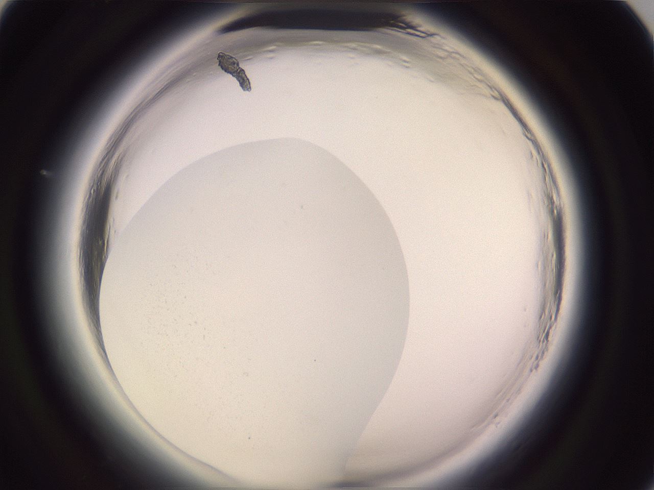 folderID647_plateID2647_batchID13509_wellNum81_profileID1_d1_r213855_ef.jpg