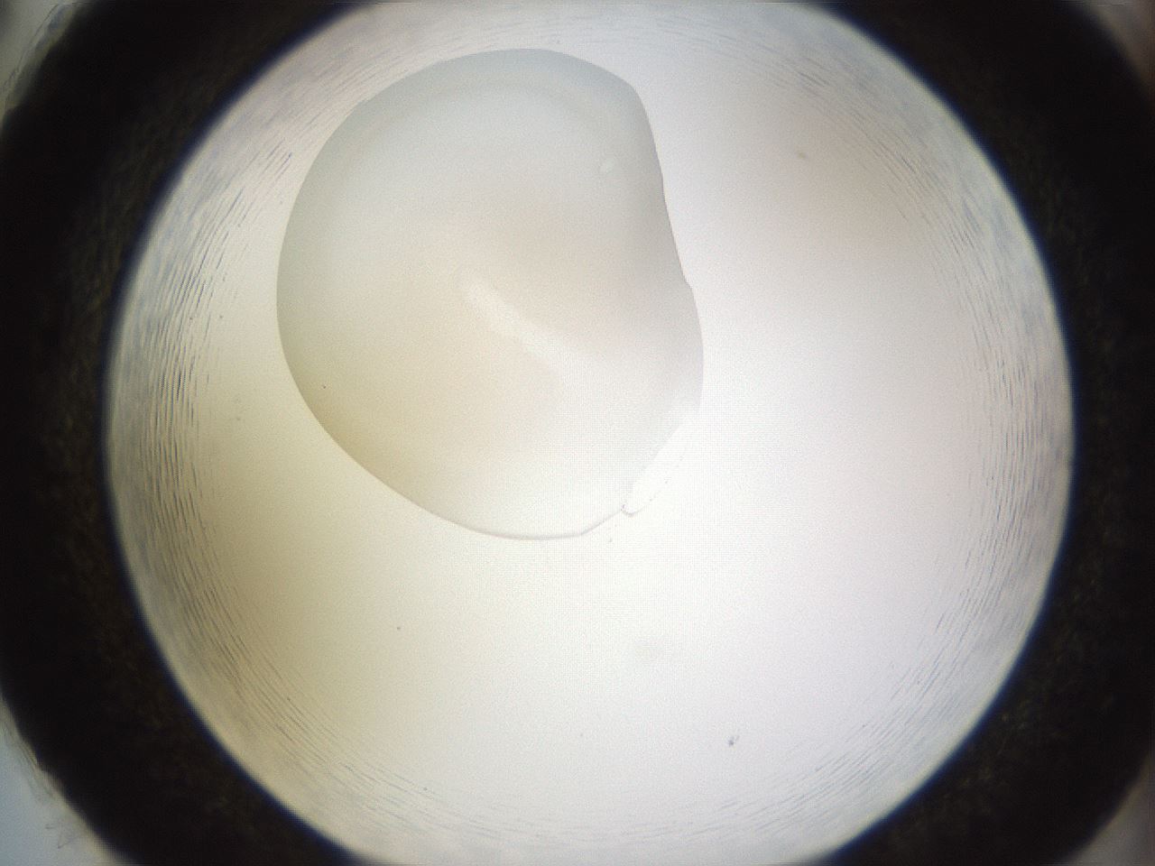 folderID795_plateID2795_batchID14948_wellNum86_profileID1_d2_r230643_ef.jpg