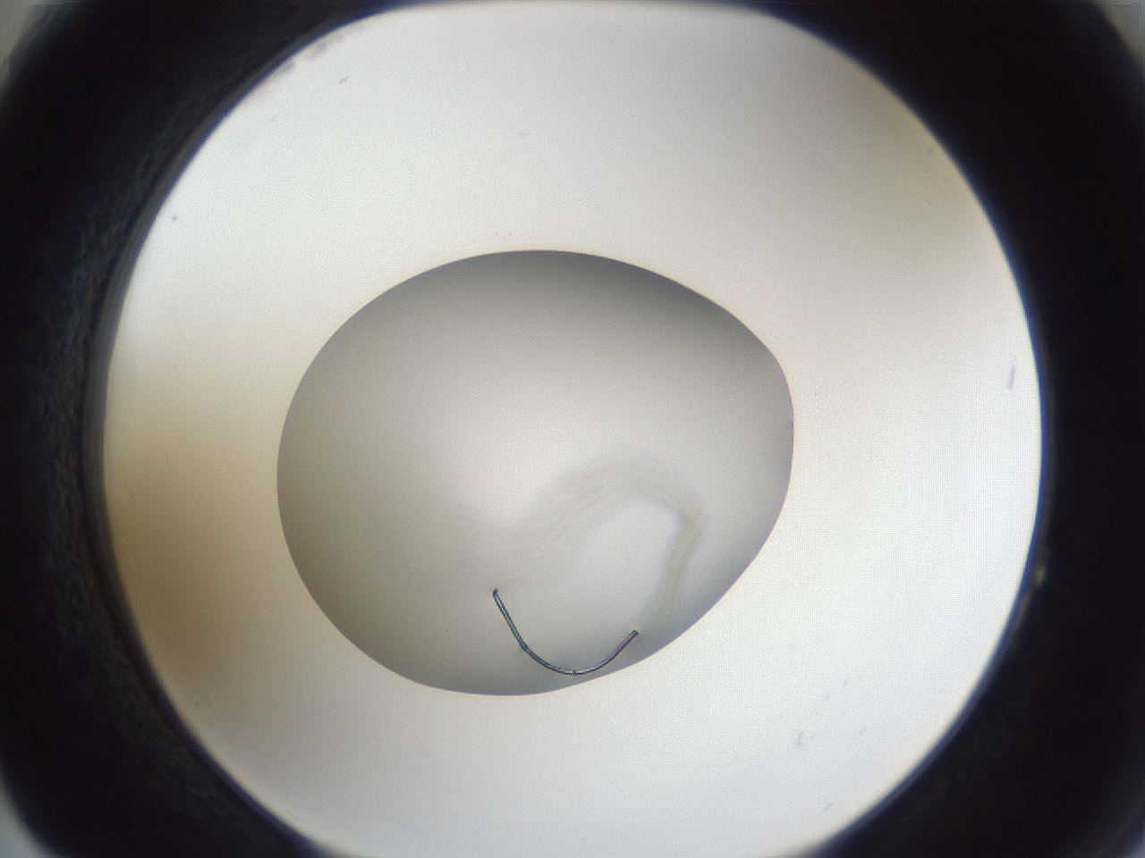 folderID847_plateID1847_batchID7911_wellNum64_profileID1_d2_r126365_ef.jpg