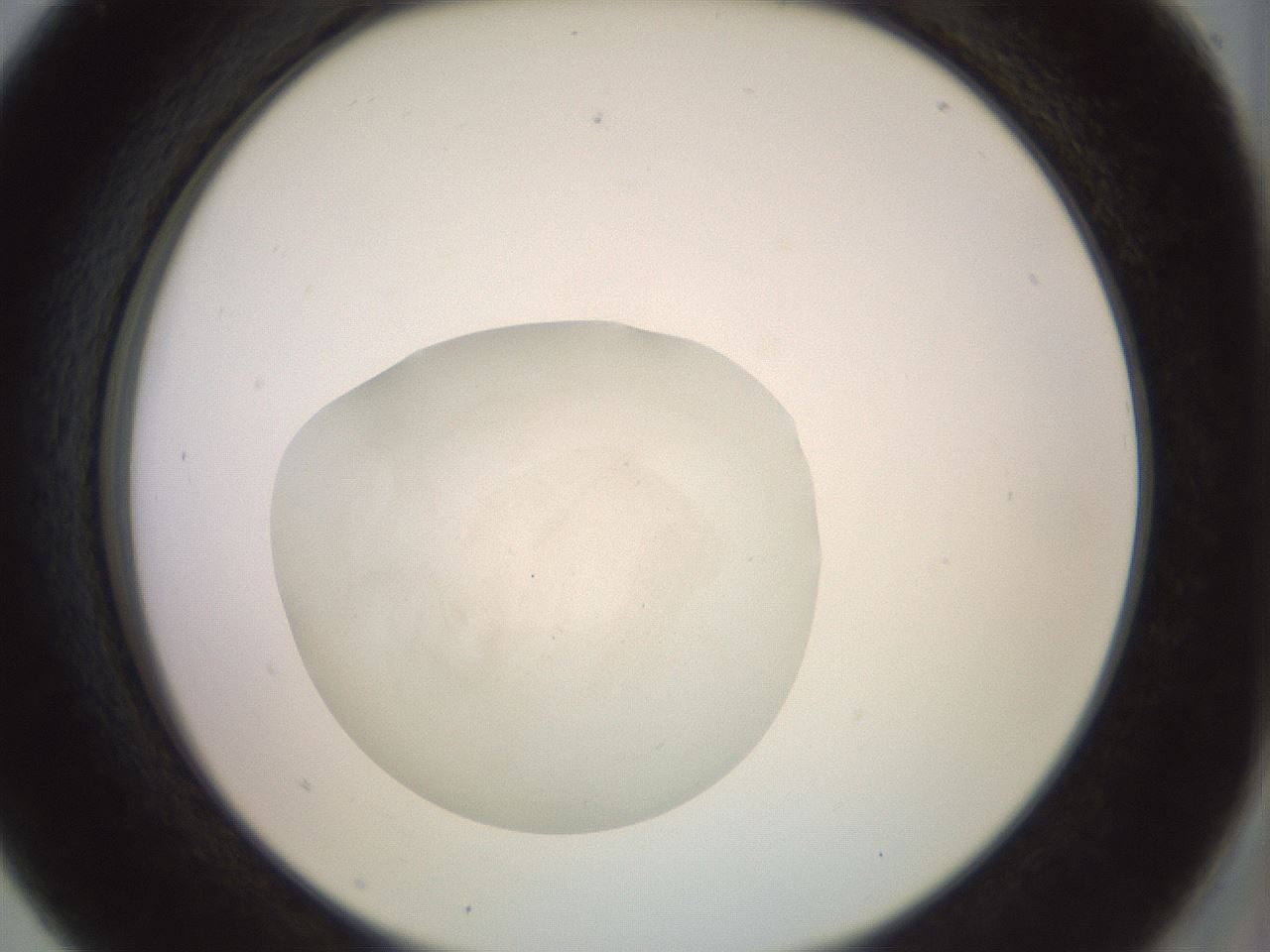 folderID849_plateID1849_batchID7896_wellNum5_profileID1_d2_r124135_ef.jpg