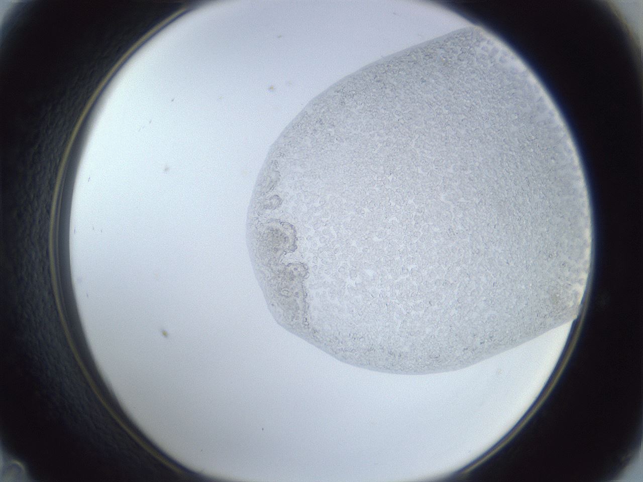 folderID879_plateID879_batchID1098_wellNum47_profileID1_d1_r31595_ef.jpg