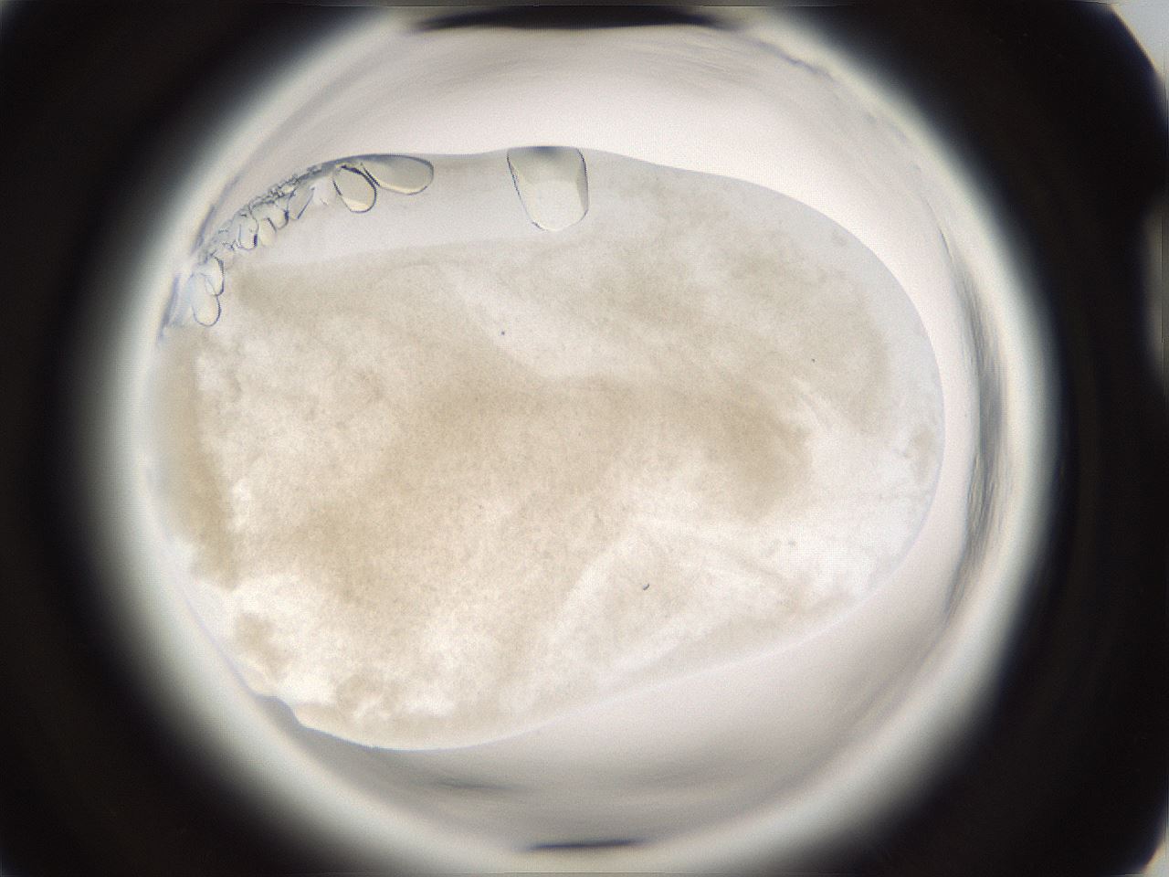 folderID661_plateID1661_batchID6958_wellNum85_profileID1_d2_r110610_ef.jpg