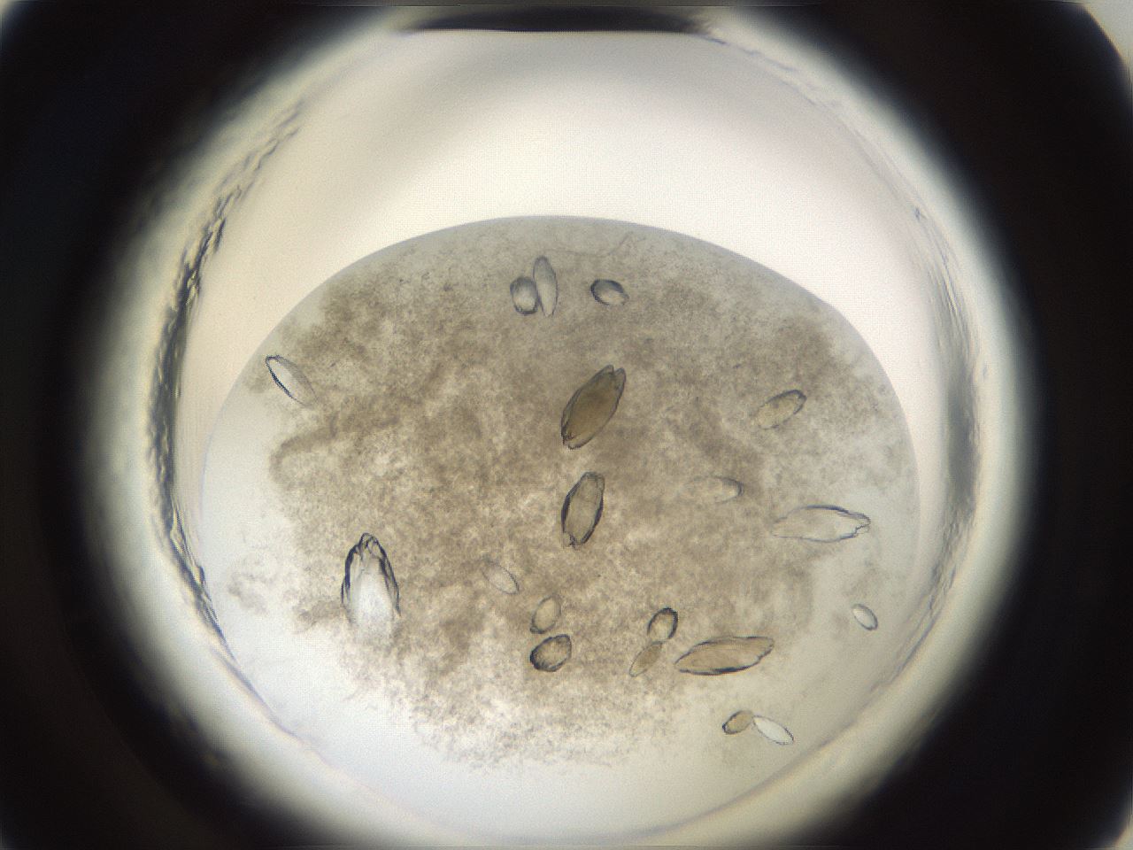 folderID696_plateID1696_batchID7042_wellNum2_profileID1_d1_r112561_ef.jpg