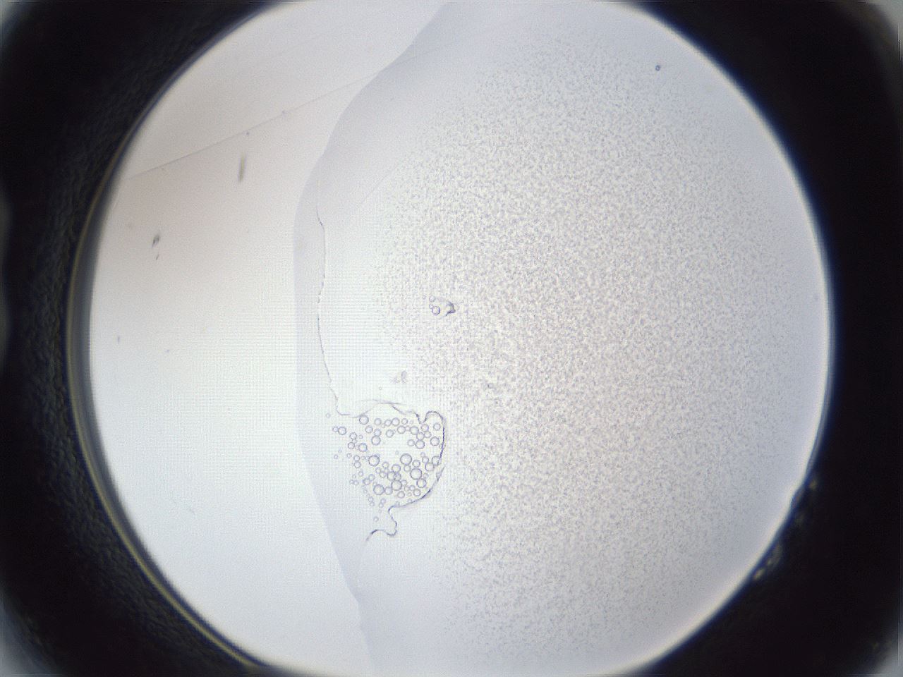 folderID641_plateID1641_batchID6863_wellNum14_profileID1_d1_r110026_ef.jpg