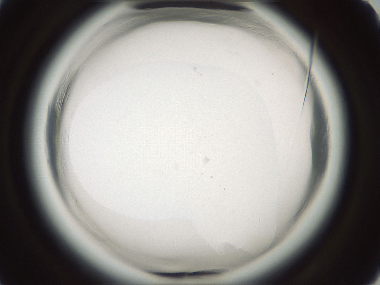 folderID643_plateID2643_batchID13390_wellNum84_profileID1_d1_r214440_ef.jpg