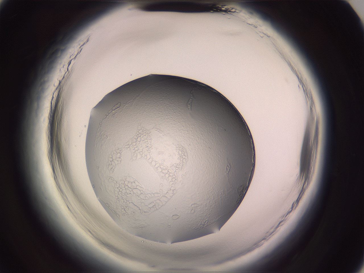 folderID646_plateID2646_batchID13385_wellNum87_profileID1_d3_r213011_ef.jpg