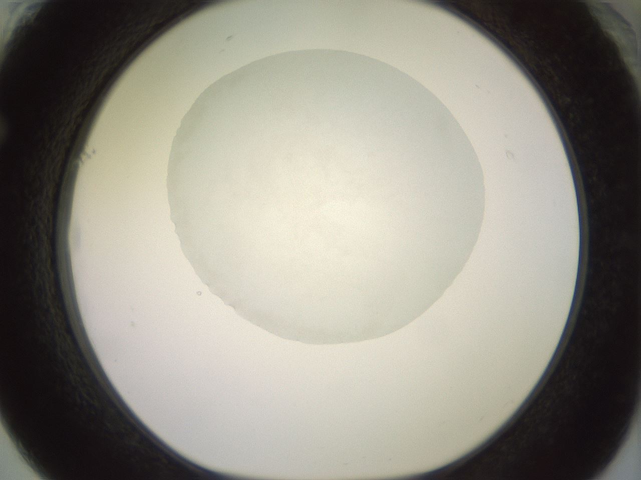 folderID851_plateID1851_batchID7908_wellNum61_profileID1_d1_r124822_ef.jpg