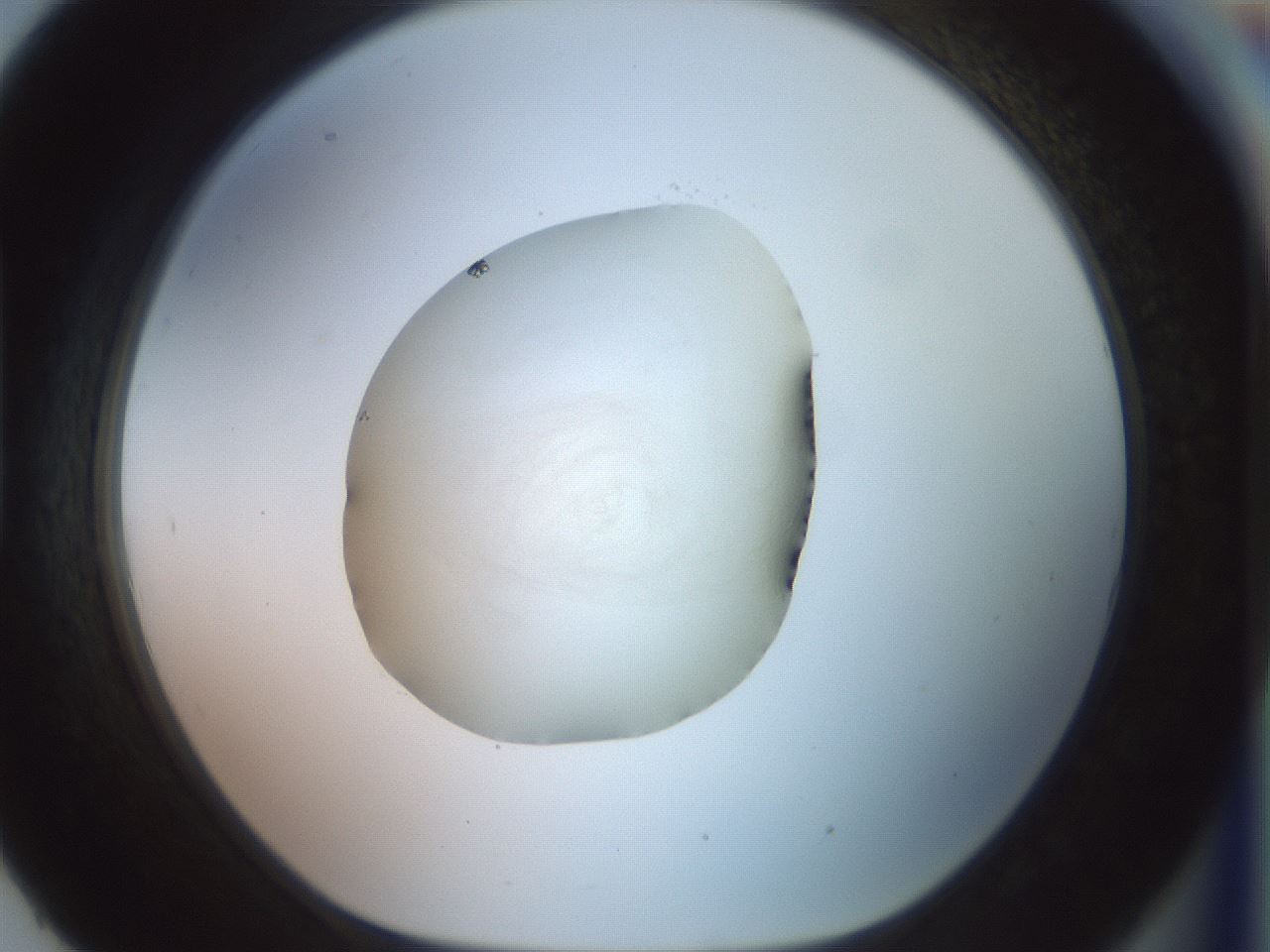 folderID853_plateID1853_batchID7900_wellNum93_profileID1_d1_r124502_ef.jpg
