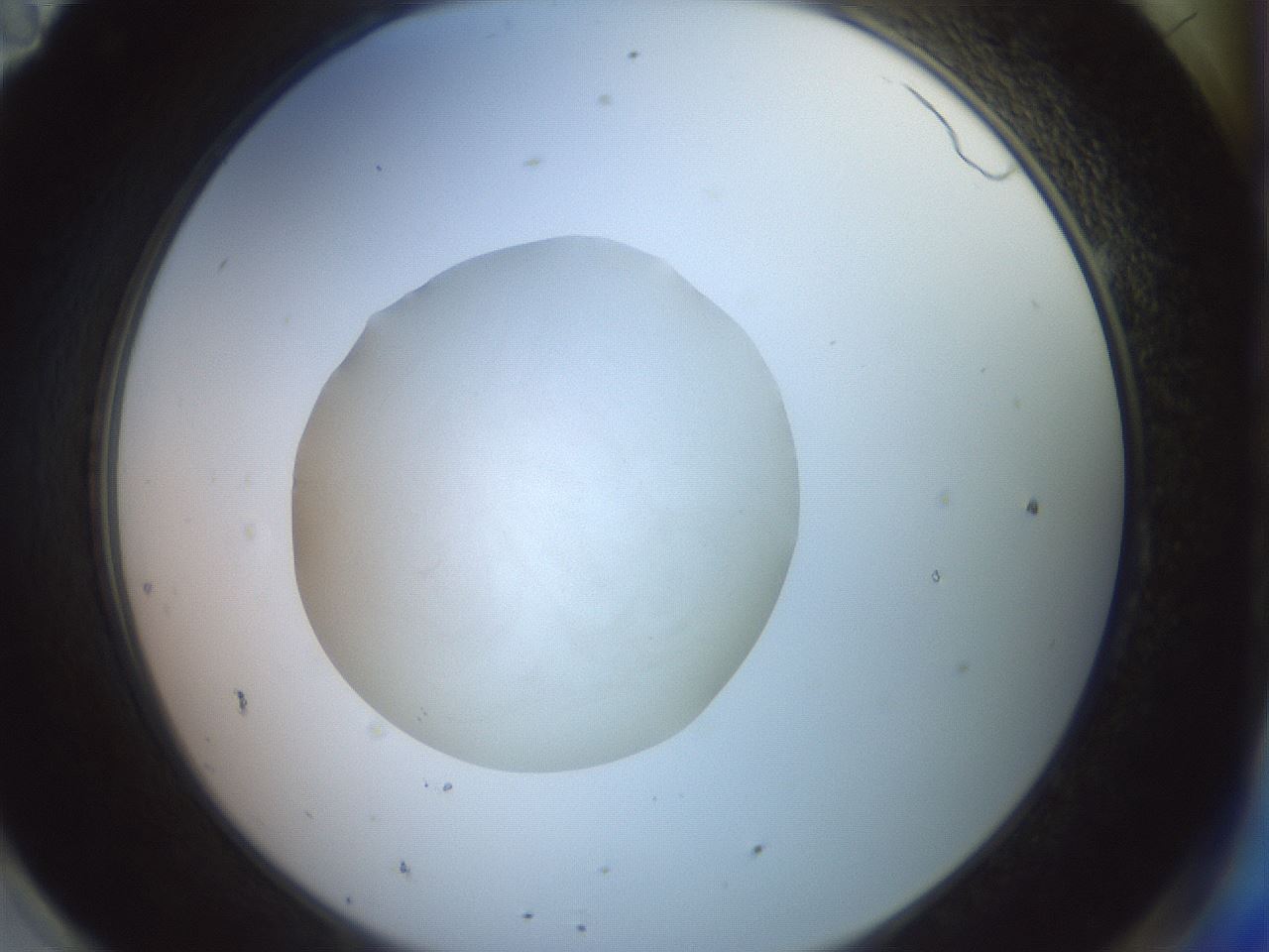 folderID856_plateID1856_batchID7888_wellNum95_profileID1_d2_r123931_ef.jpg