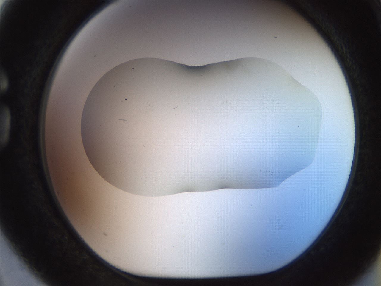 folderID916_plateID1916_batchID8276_wellNum75_profileID1_d1_r128368_ef.jpg