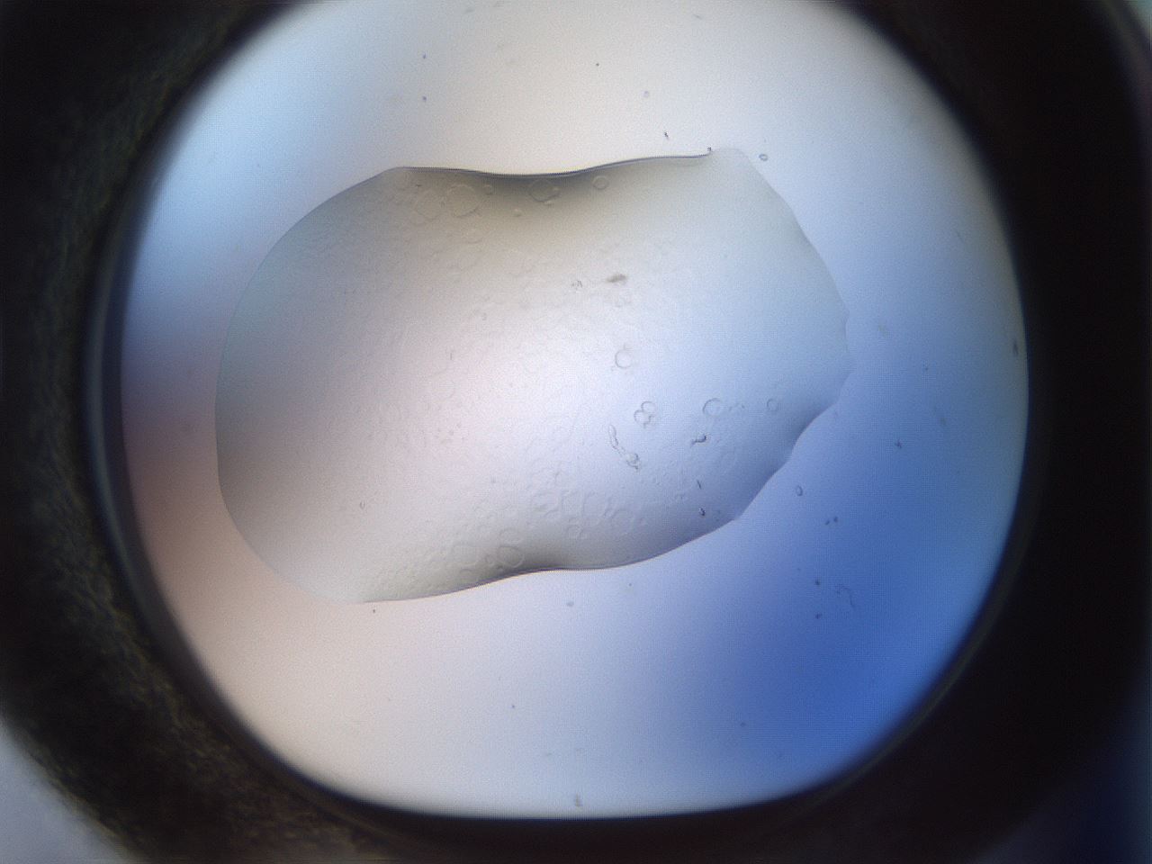 folderID916_plateID1916_batchID8276_wellNum80_profileID1_d1_r128373_ef.jpg