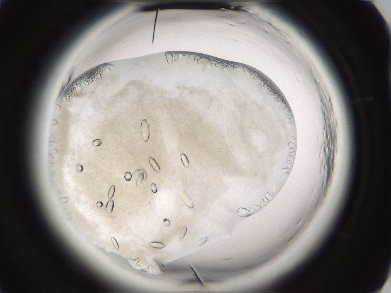 folderID661_plateID1661_batchID6958_wellNum25_profileID1_d2_r110475_ef.jpg