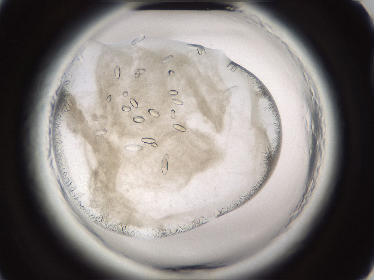 folderID661_plateID1661_batchID6958_wellNum26_profileID1_d2_r110478_ef.jpg