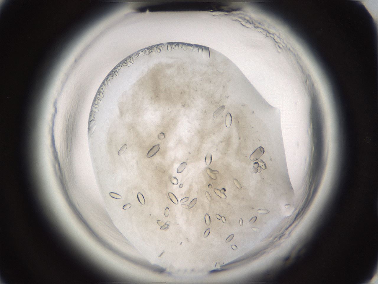 folderID661_plateID1661_batchID6958_wellNum40_profileID1_d2_r110511_ef.jpg