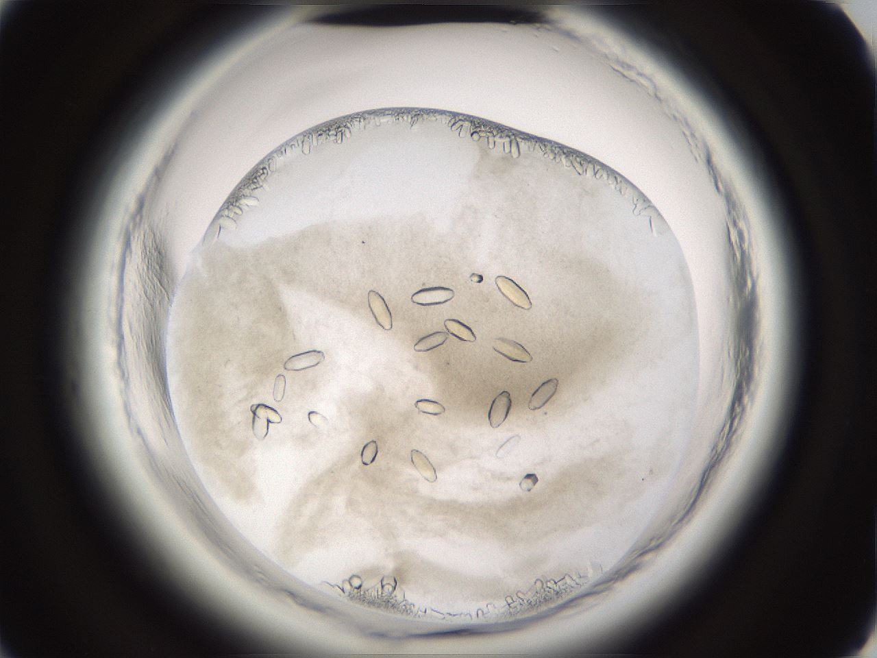 folderID661_plateID1661_batchID6958_wellNum50_profileID1_d2_r110532_ef.jpg