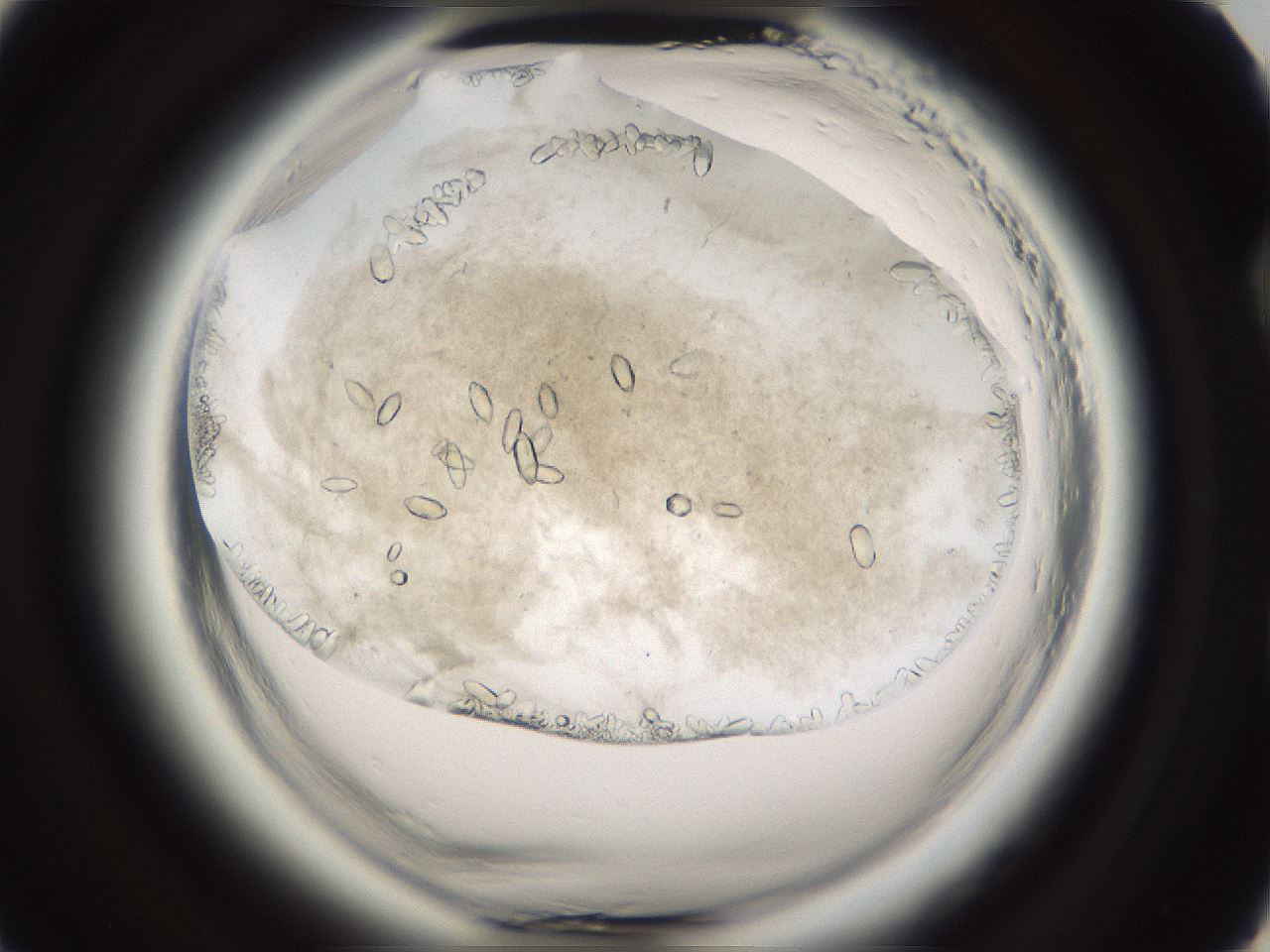 folderID661_plateID1661_batchID6958_wellNum81_profileID1_d2_r110607_ef.jpg