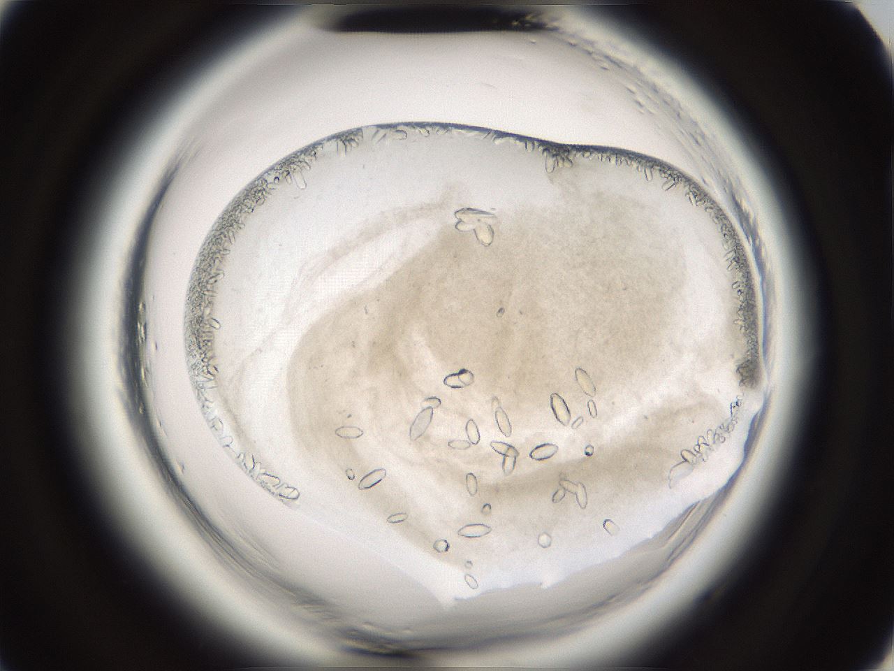 folderID661_plateID1661_batchID6958_wellNum91_profileID1_d2_r110628_ef.jpg