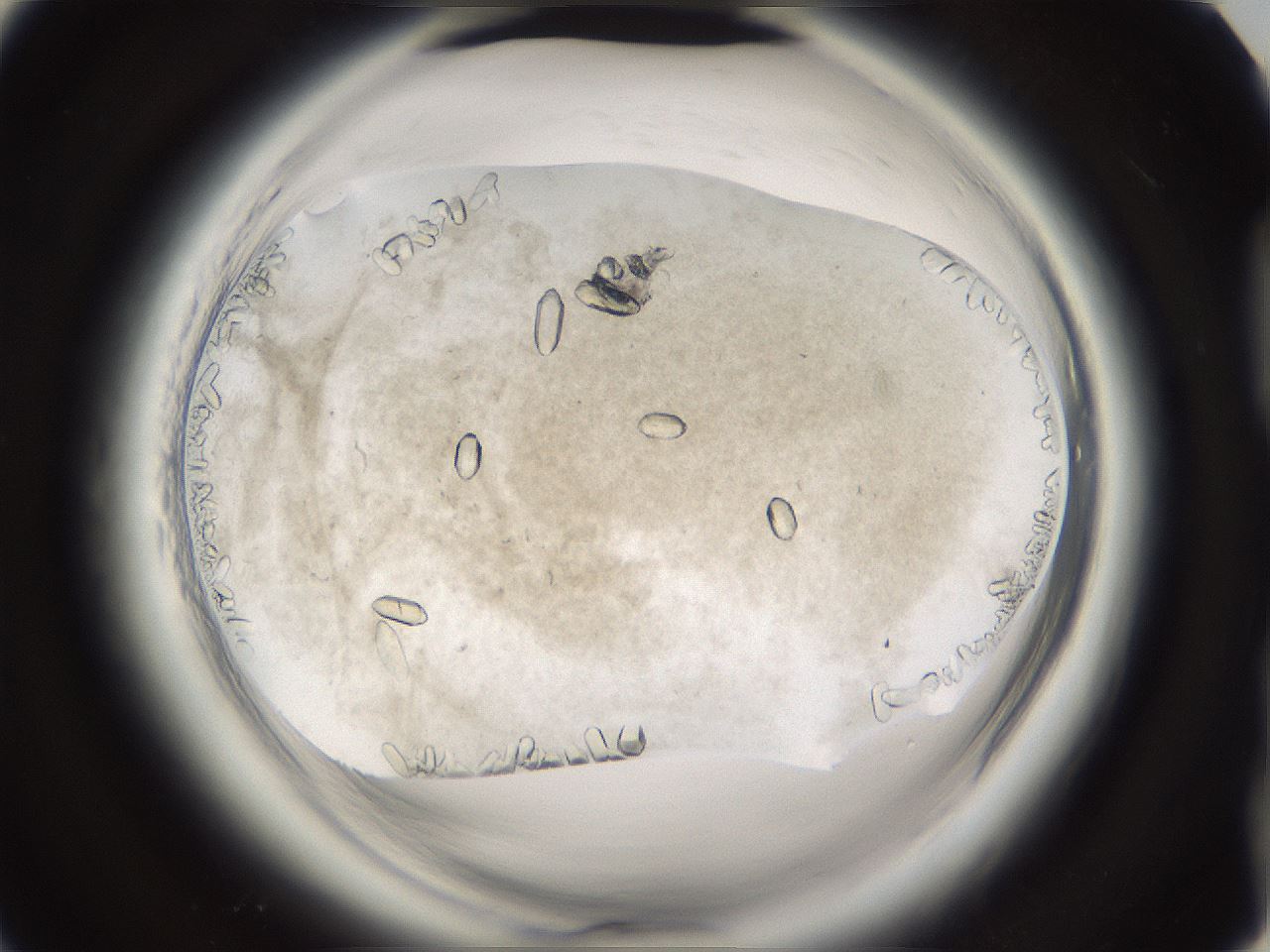 folderID661_plateID1661_batchID6958_wellNum92_profileID1_d2_r110631_ef.jpg