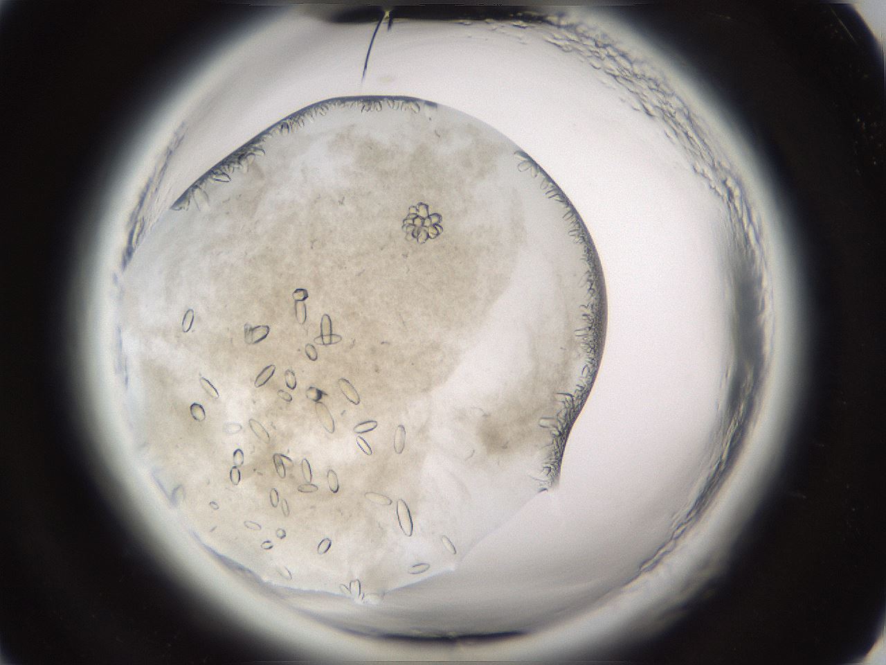 folderID661_plateID1661_batchID6961_wellNum16_profileID1_d2_r110457_ef.jpg