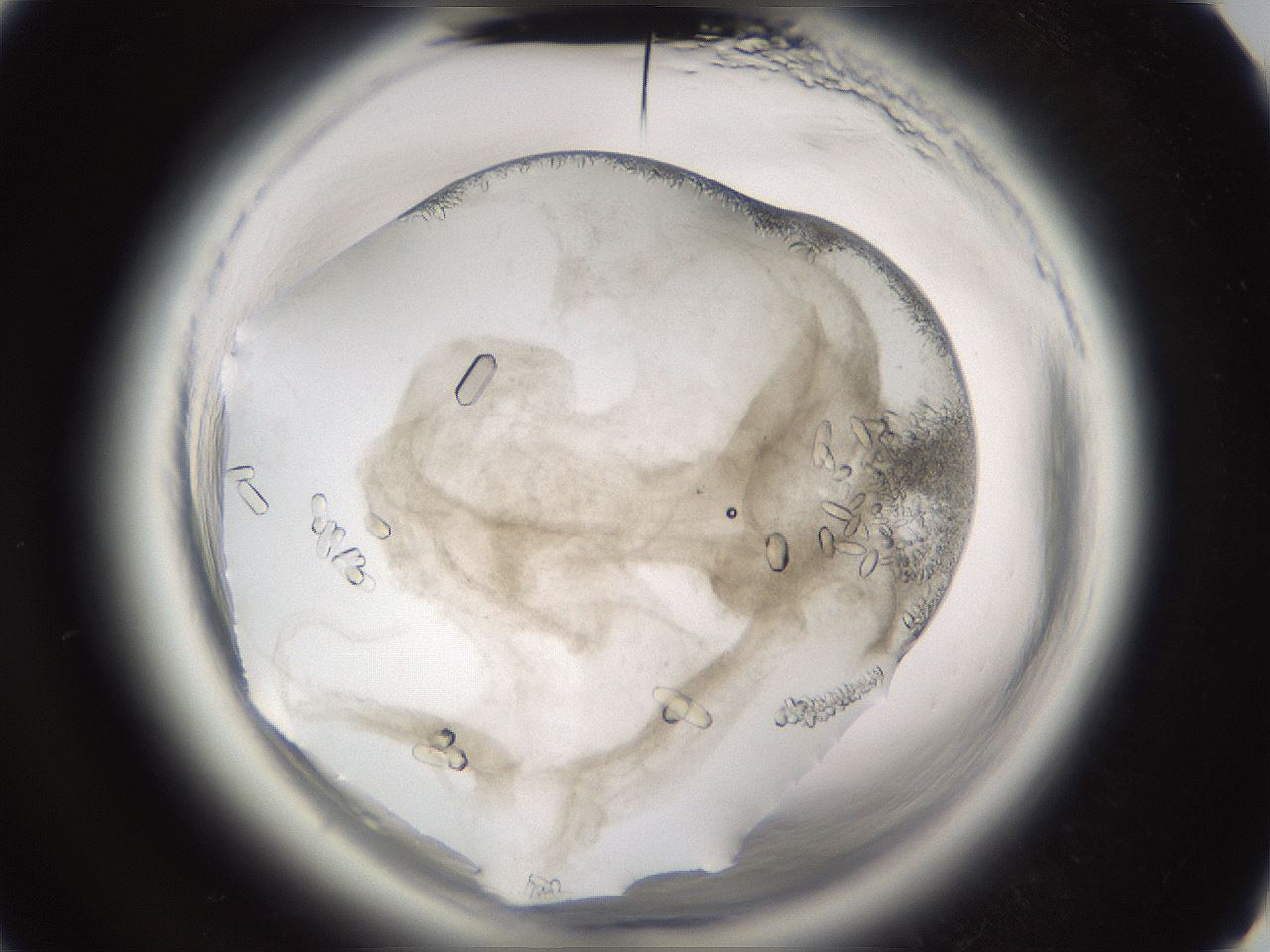 folderID661_plateID1661_batchID6961_wellNum28_profileID1_d3_r110485_ef.jpg