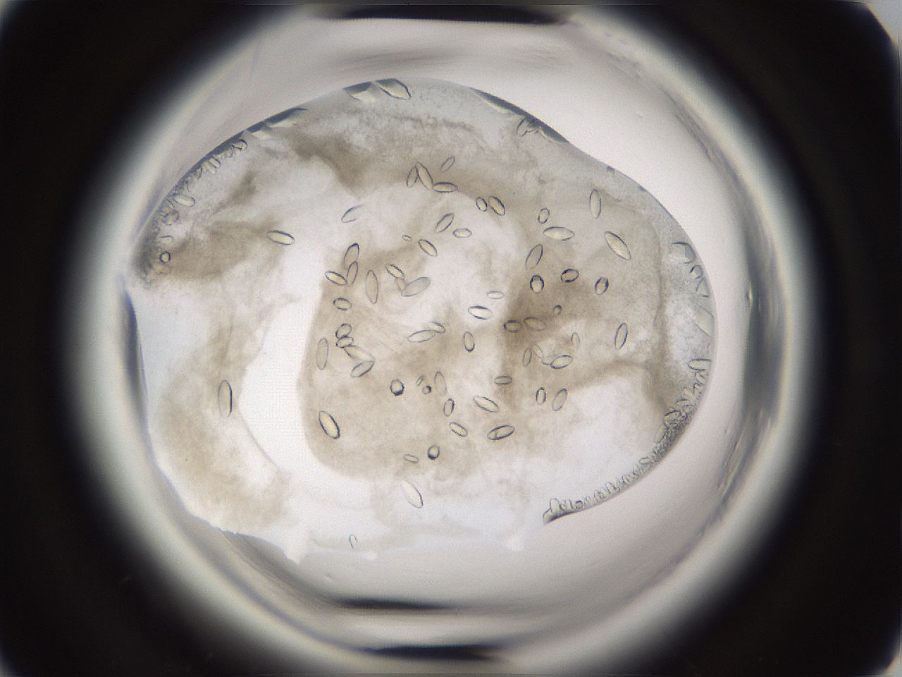 folderID661_plateID1661_batchID6961_wellNum41_profileID1_d2_r110514_ef.jpg