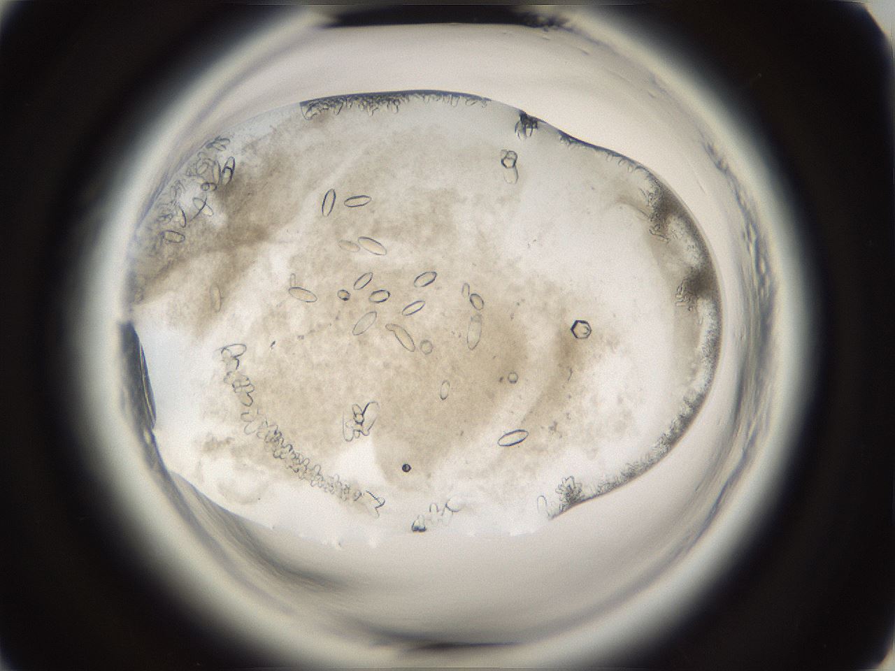 folderID661_plateID1661_batchID6961_wellNum44_profileID1_d2_r110523_ef.jpg