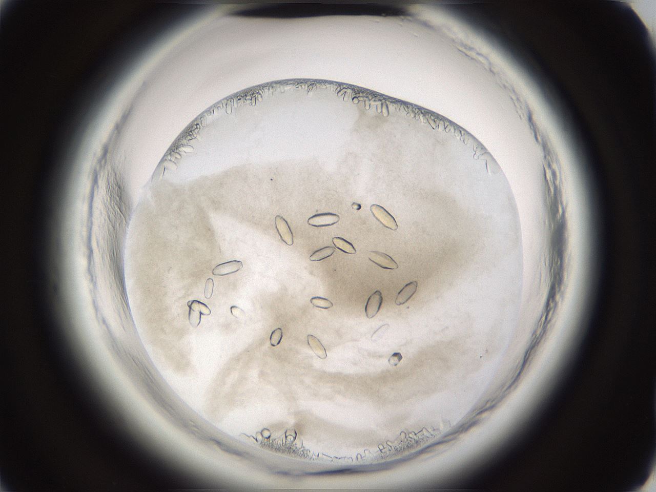 folderID661_plateID1661_batchID6961_wellNum50_profileID1_d2_r110532_ef.jpg