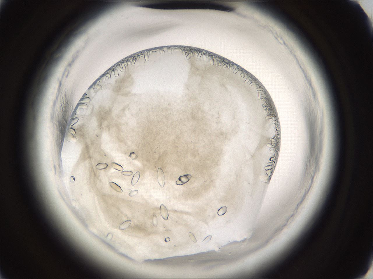 folderID661_plateID1661_batchID6961_wellNum51_profileID1_d2_r110535_ef.jpg