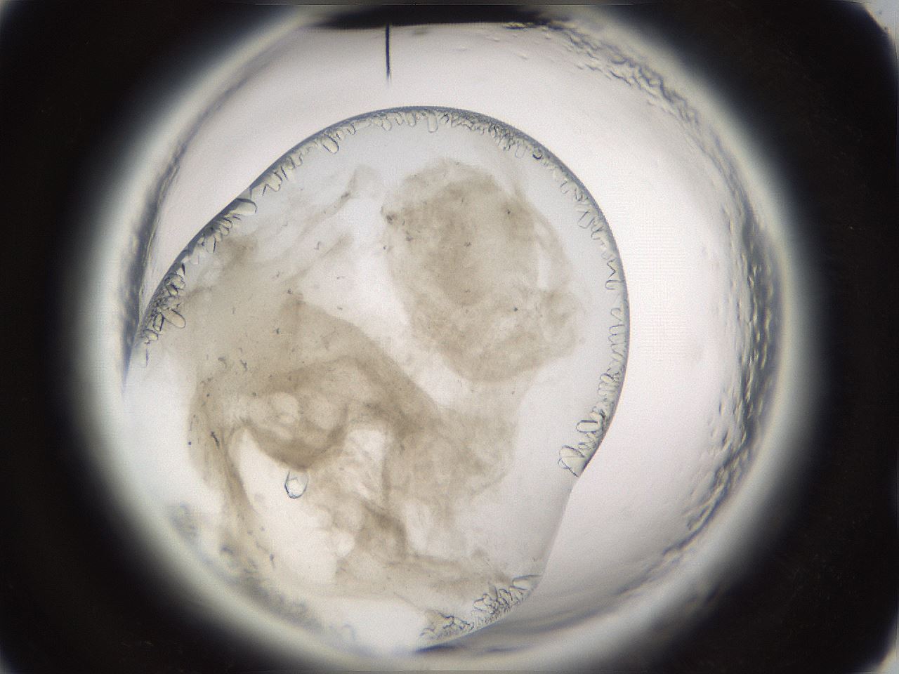 folderID661_plateID1661_batchID6961_wellNum52_profileID1_d2_r110538_ef.jpg