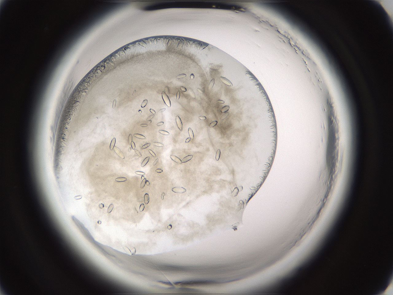 folderID661_plateID1661_batchID6961_wellNum17_profileID1_d2_r110460_ef.jpg