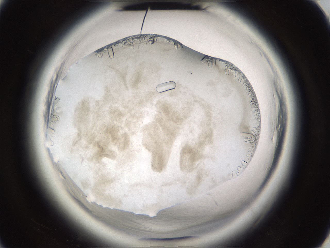 folderID661_plateID1661_batchID6961_wellNum62_profileID1_d3_r110560_ef.jpg