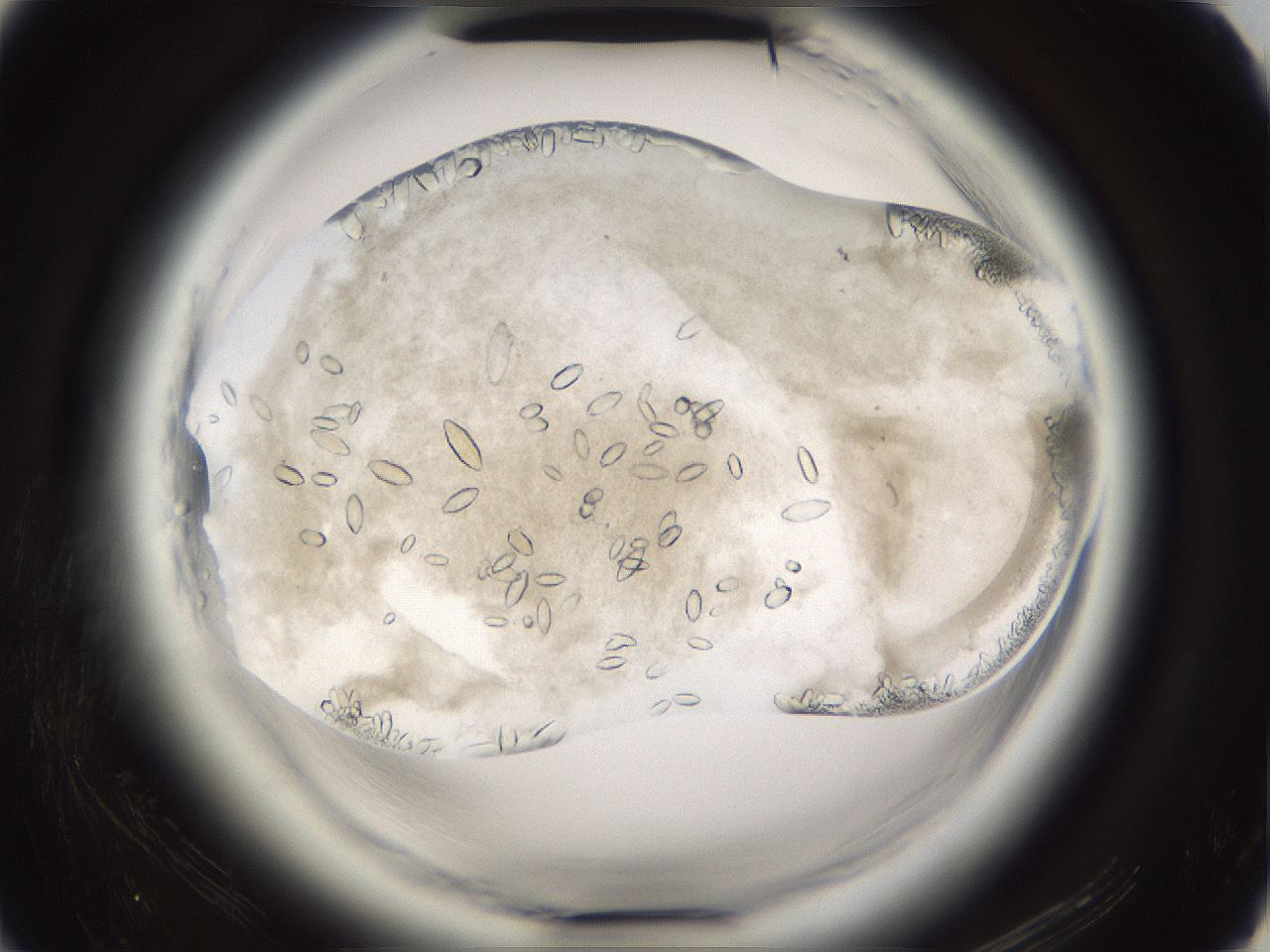 folderID661_plateID1661_batchID6961_wellNum66_profileID1_d2_r110571_ef.jpg