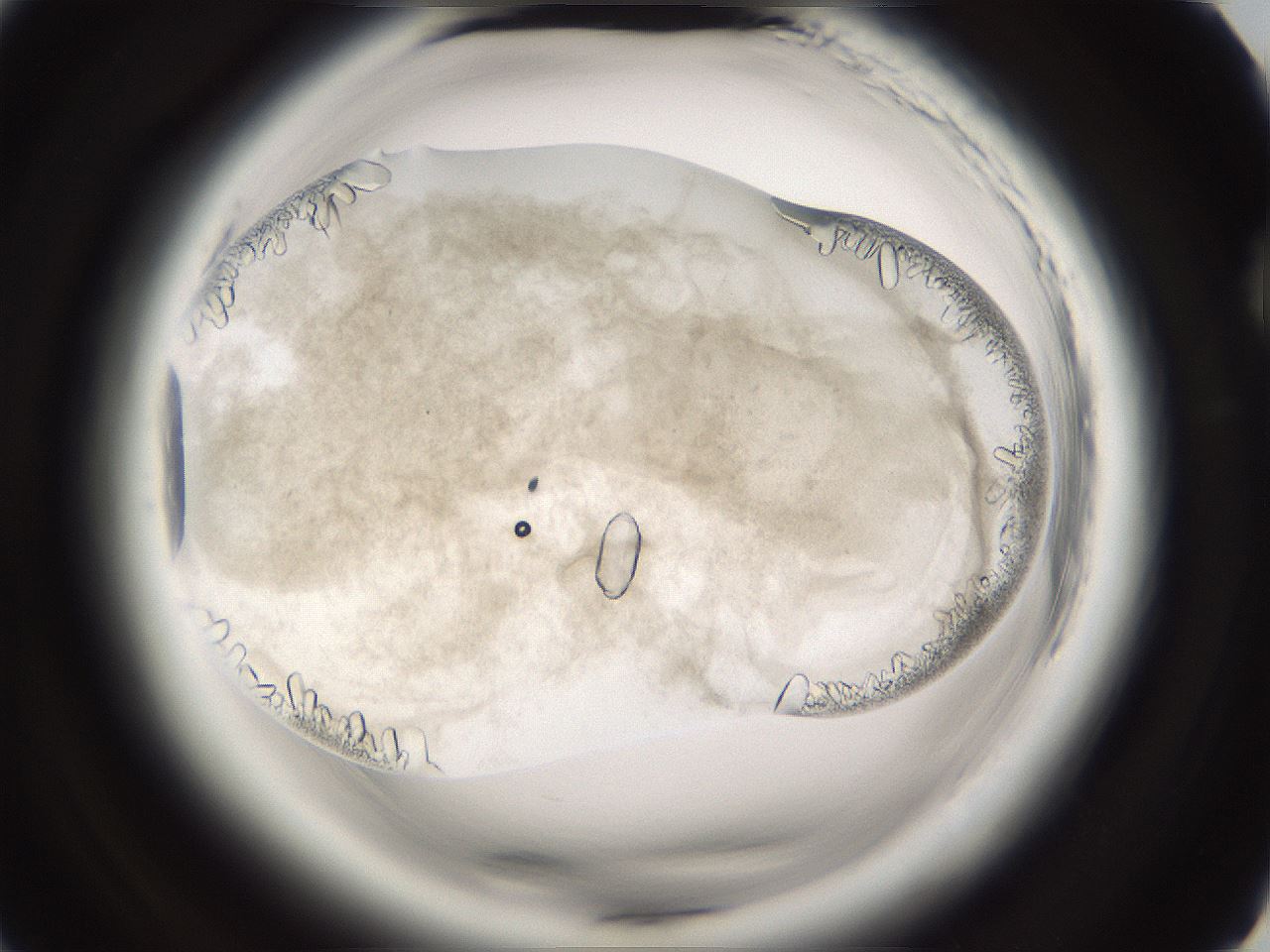 folderID661_plateID1661_batchID6961_wellNum73_profileID1_d2_r110583_ef.jpg