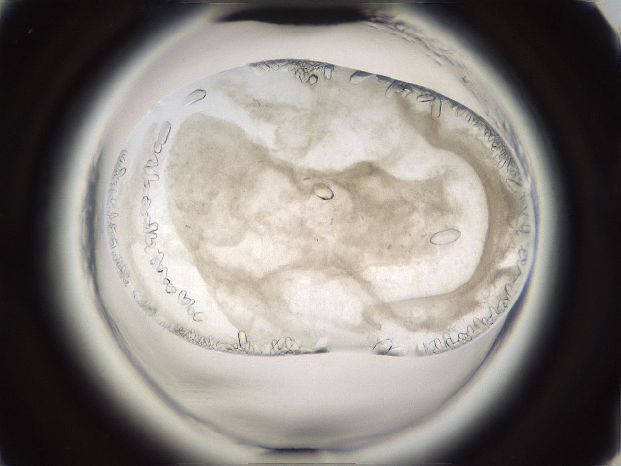 folderID661_plateID1661_batchID6961_wellNum78_profileID1_d2_r110598_ef.jpg