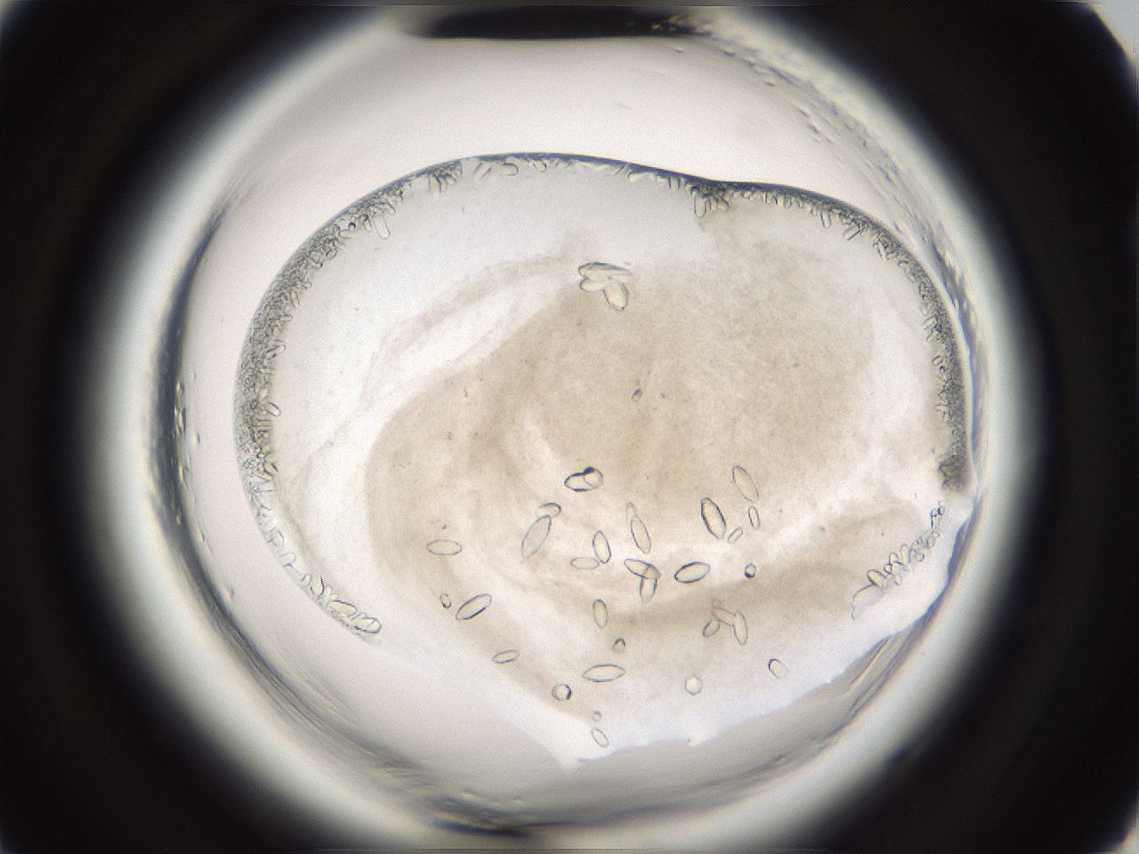folderID661_plateID1661_batchID6961_wellNum91_profileID1_d2_r110628_ef.jpg