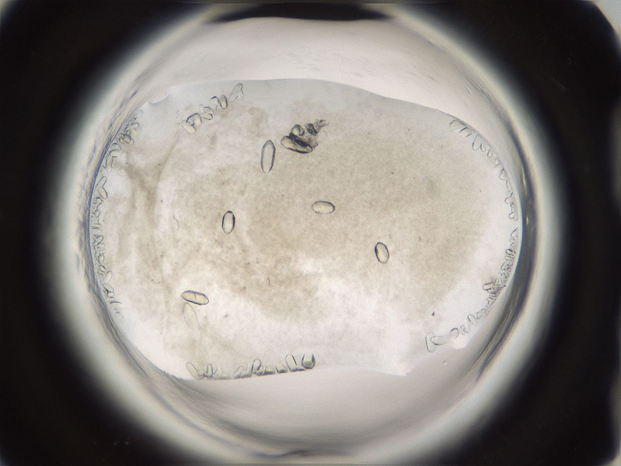 folderID661_plateID1661_batchID6961_wellNum92_profileID1_d2_r110631_ef.jpg