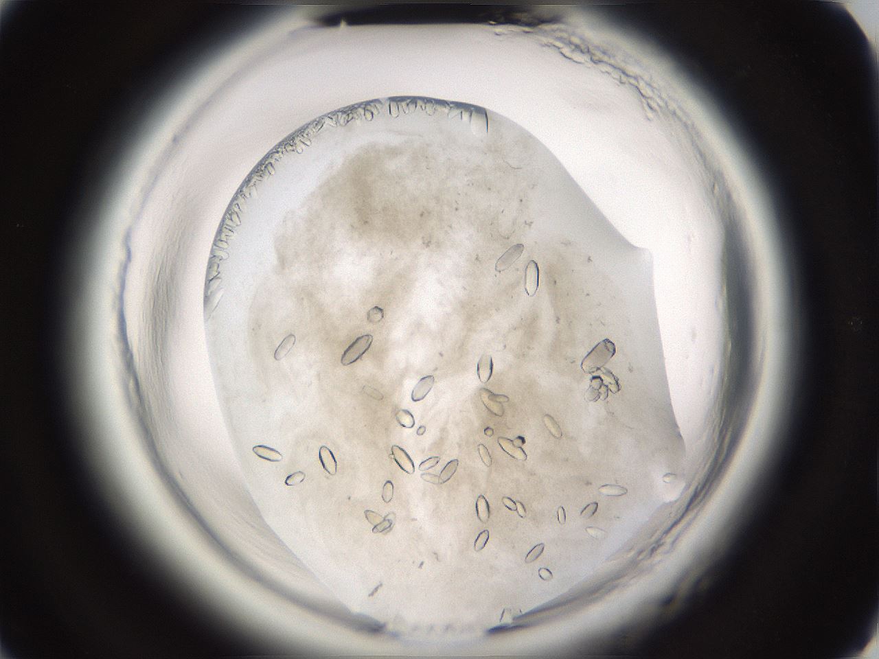 folderID661_plateID1661_batchID6964_wellNum40_profileID1_d2_r110511_ef.jpg