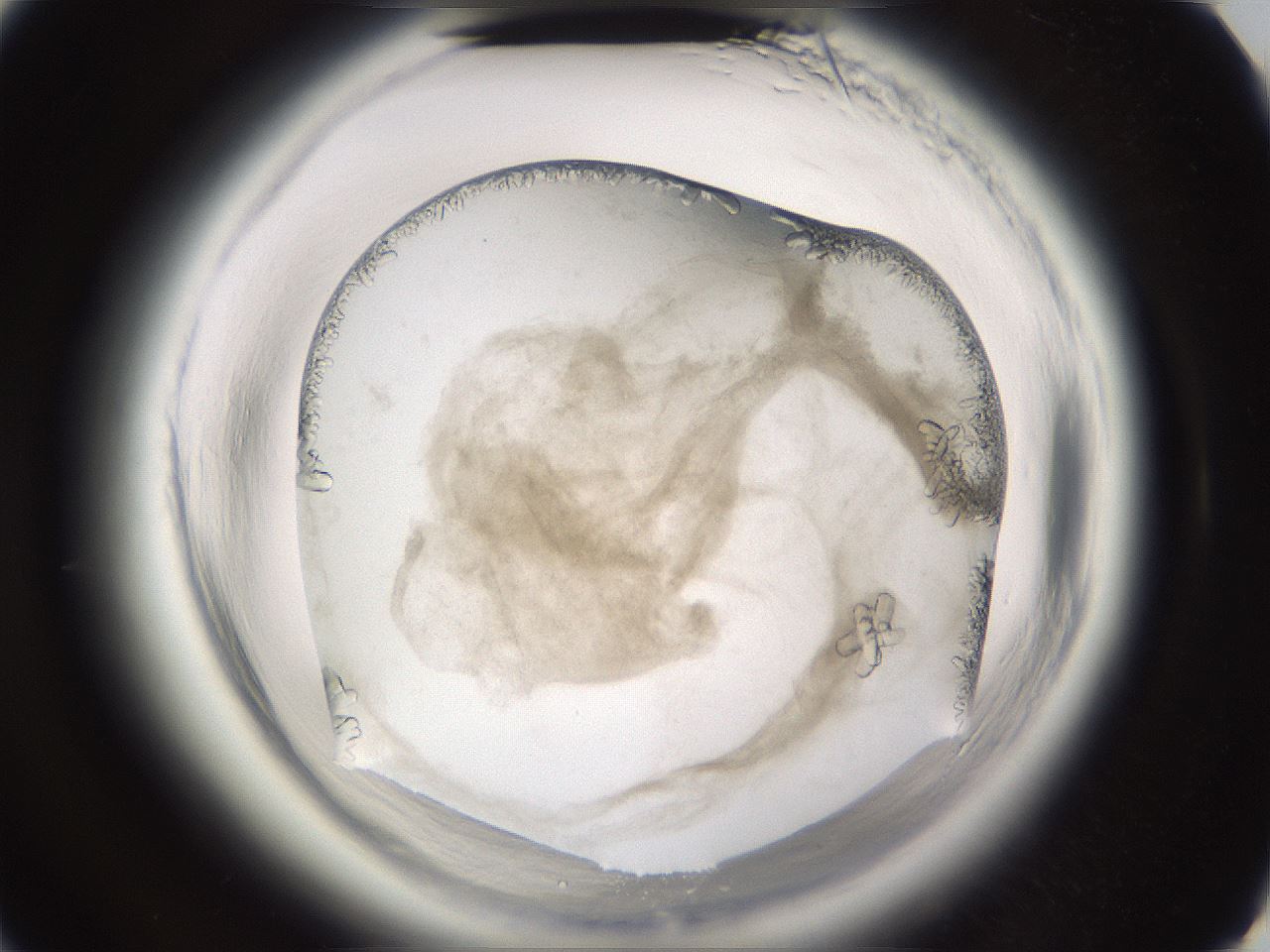 folderID661_plateID1661_batchID6964_wellNum40_profileID1_d3_r110512_ef.jpg