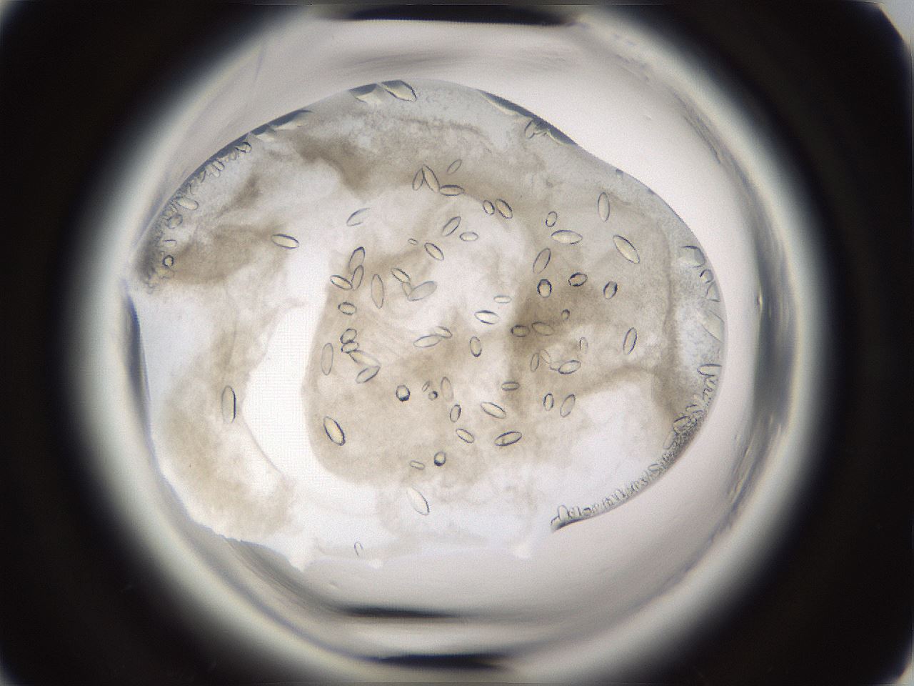folderID661_plateID1661_batchID6964_wellNum41_profileID1_d2_r110514_ef.jpg